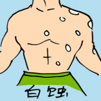 0895<br>白蚀<br>白蝕<br>Vitiligo<br>Skin<br>Disease